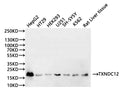 Western Blot
Positive WB detected in: HepG2 whole cell lysate(30µg), HT-29 whole cell lysate(30µg), HEK293 whole cell lysate(30µg), U-251MG whole cell lysate(30µg), SH-SY5Y whole cell lysate(30µg), K562 whole cell lysate(30µg), Rat liver tissue lysate(30µg)
All lanes:TXNDC12 antibody at 1:1000
Secondary
Goat polyclonal to rabbit IgG at 1/40000 dilution
Predicted band size: 19 kDa
Observed band size: 19 kDa
Exposure time：3min