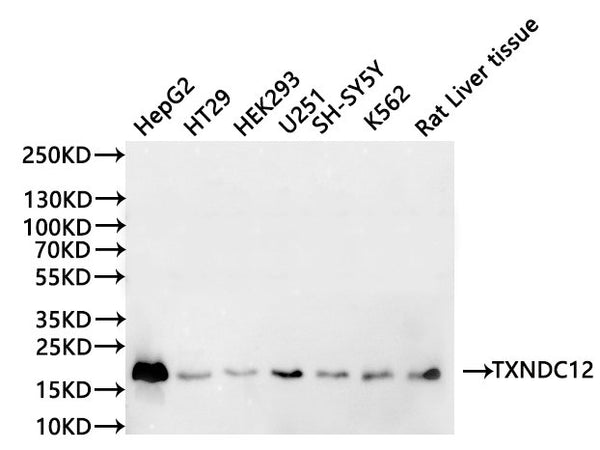 Western Blot
Positive WB detected in: HepG2 whole cell lysate(30µg), HT-29 whole cell lysate(30µg), HEK293 whole cell lysate(30µg), U-251MG whole cell lysate(30µg), SH-SY5Y whole cell lysate(30µg), K562 whole cell lysate(30µg), Rat liver tissue lysate(30µg)
All lanes:TXNDC12 antibody at 1:1000
Secondary
Goat polyclonal to rabbit IgG at 1/40000 dilution
Predicted band size: 19 kDa
Observed band size: 19 kDa
Exposure time：3min