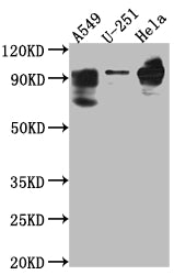 PDE4D Antibody – Figure 1 of 1