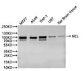 Western Blot
Positive WB detected in: Hela whole cell lysate(30µg), HEK293 whole cell lysate(30µg), A549 whole cell lysate(30µg), THP-1 whole cell lysate(30µg), U-87MG whole cell lysate(30µg), Rat brain tissue lysate(30µg)
All lanes: NCL antibody at 1:1000
Secondary
Goat polyclonal to rabbit IgG at 1/40000 dilution
Predicted band size: 77 kDa
Observed band size: 100 kDa
Exposure time：10s