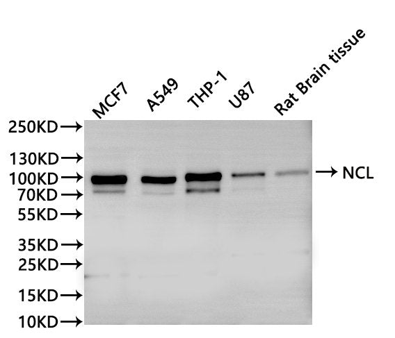 Western Blot
Positive WB detected in: Hela whole cell lysate(30µg), HEK293 whole cell lysate(30µg), A549 whole cell lysate(30µg), THP-1 whole cell lysate(30µg), U-87MG whole cell lysate(30µg), Rat brain tissue lysate(30µg)
All lanes: NCL antibody at 1:1000
Secondary
Goat polyclonal to rabbit IgG at 1/40000 dilution
Predicted band size: 77 kDa
Observed band size: 100 kDa
Exposure time：10s