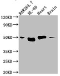 Western Blot
Positive WB detected in: RAW264.7 whole cell lysate, HL-60 whole cell lysate, Mouse Herat whole cell lysate, Mouse Brain whole cell lysate
All lanes: Tin2 antibody at 1:1000
Secondary
Goat polyclonal to rabbit IgG at 1/50000 dilution
Predicted band size: 51, 40, 16 kDa
Observed band size: 51 kDa