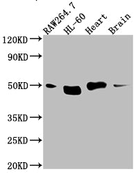 Western Blot
Positive WB detected in: RAW264.7 whole cell lysate, HL-60 whole cell lysate, Mouse Herat whole cell lysate, Mouse Brain whole cell lysate
All lanes: Tin2 antibody at 1:1000
Secondary
Goat polyclonal to rabbit IgG at 1/50000 dilution
Predicted band size: 51, 40, 16 kDa
Observed band size: 51 kDa