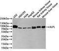 Western Blot
Positive WB detected in: LO2 whole cell lysate(30µg) , HEK293 whole cell lysate(30µg) , Hela whole cell lysate(30µg) , HepG2 whole cell lysate(30µg) , Mouse kidney tissue lysate(20µg) , Rat kidney tissue lysate(20µg) , Mouse liver tissue lysate(20µg) 
All lanes: ALPL antibody at 1:1000
Secondary
Goat polyclonal to rabbit IgG at 1/40000 dilution
Predicted band size: 57 kDa
Observed band size: 75 kDa
Exposure time：2min