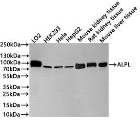 Western Blot
Positive WB detected in: LO2 whole cell lysate(30µg) , HEK293 whole cell lysate(30µg) , Hela whole cell lysate(30µg) , HepG2 whole cell lysate(30µg) , Mouse kidney tissue lysate(20µg) , Rat kidney tissue lysate(20µg) , Mouse liver tissue lysate(20µg) 
All lanes: ALPL antibody at 1:1000
Secondary
Goat polyclonal to rabbit IgG at 1/40000 dilution
Predicted band size: 57 kDa
Observed band size: 75 kDa
Exposure time：2min