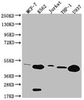 Western Blot
Positive WB detected in: MCF-7 whole cell lysate, K562 whole cell lysate, Jurkat whole cell lysate, THP-1 whole cell lysate, U937 whole cell lysate
All lanes: HMBS antibody at 1:2000
Secondary
Goat polyclonal to rabbit IgG at 1/50000 dilution
Predicted band size: 40, 38, 35, 34kDa
Observed band size: 36-55 kDa