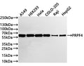Western Blot
Positive WB detected in: A549 whole cell lysate(20µg) ,HEK293 whole cell lysate(20µg) , Hela whole cell lysate(20µg) , COLO-205 whole cell lysate(20µg) ,Raji whole cell lysate(20µg) ,HepG2 whole cell lysate(20µg) 
All lanes: PRPF4 antibody at 1:1000
Secondary
Goat polyclonal to rabbit IgG at 1/40000 dilution
Predicted band size: 58 kDa
Observed band size: 58 kDa
Exposure time：2min