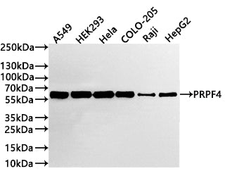 Western Blot
Positive WB detected in: A549 whole cell lysate(20µg) ,HEK293 whole cell lysate(20µg) , Hela whole cell lysate(20µg) , COLO-205 whole cell lysate(20µg) ,Raji whole cell lysate(20µg) ,HepG2 whole cell lysate(20µg) 
All lanes: PRPF4 antibody at 1:1000
Secondary
Goat polyclonal to rabbit IgG at 1/40000 dilution
Predicted band size: 58 kDa
Observed band size: 58 kDa
Exposure time：2min
