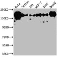 Western Blot
Positive WB detected in: Hela whole cell lysate, Jurkat whole cell lysate, 293 whole cell lysate, MCF-7 whole cell lysate, 293T whole cell lysate, HepG2 whole cell lysate
All lanes: PELP1 antibody at 1:1000
Secondary
Goat polyclonal to rabbit IgG at 1/50000 dilution
Predicted band size: 120 kDa
Observed band size: 160 kDa