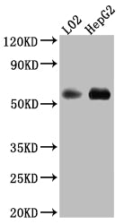 MAOB Antibody – Figure 1 of 3