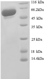 Recombinant Human Glyceraldehyde-3-phosphate dehydrogenase (GAPDH), partial – Figure 1 of 1