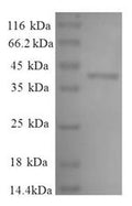 (Tris-Glycine gel) Discontinuous SDS-PAGE (reduced) with 5% enrichment gel and 15% separation gel.