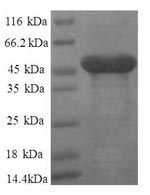 Recombinant Human 60S ribosomal protein L11 (RPL11), partial – Figure 1 of 1