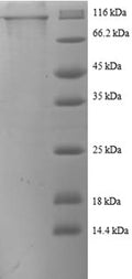(Tris-Glycine gel) Discontinuous SDS-PAGE (reduced) with 5% enrichment gel and 15% separation gel.