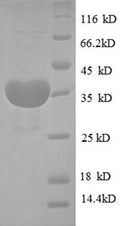 (Tris-Glycine gel) Discontinuous SDS-PAGE (reduced) with 5% enrichment gel and 15% separation gel.