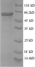 Recombinant Human Protein disulfide-isomerase (P4HB), partial – Figure 1 of 1
