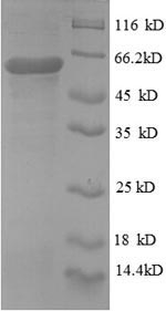 Recombinant Human Protein disulfide-isomerase (P4HB), partial – Figure 1 of 1
