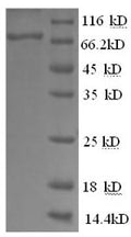 Recombinant Human Glucose-6-phosphate isomerase (GPI), partial – Figure 1 of 1