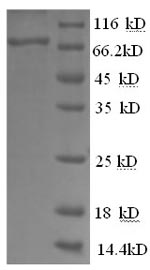 Recombinant Human Glucose-6-phosphate isomerase (GPI), partial – Figure 1 of 1