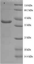 Recombinant Human Cytochrome c oxidase subunit 5A, mitochondrial (COX5A) – Figure 1 of 1