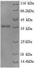 Recombinant Human Heat shock factor-binding protein 1 (HSBP1), partial – Figure 1 of 1