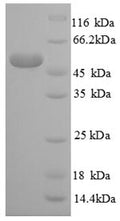 Recombinant Human Large ribosomal subunit protein eL14 (RPL14), partial – Figure 1 of 1