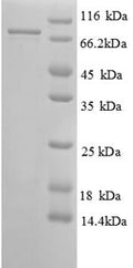 Recombinant Human 26S proteasome non-ATPase regulatory subunit 11 (PSMD11) – Figure 1 of 1