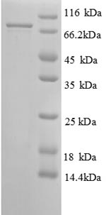 Recombinant Human 26S proteasome non-ATPase regulatory subunit 11 (PSMD11) – Figure 1 of 1