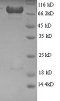 Recombinant Human 60S ribosomal protein L8 (RPL8), partial – Figure 1 of 1