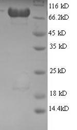 Recombinant Human 60S ribosomal protein L8 (RPL8), partial – Figure 1 of 1