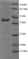Recombinant Human ATP synthase subunit delta, mitochondrial (ATP5F1D), partial – Figure 1 of 1
