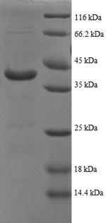 Recombinant Human ATP synthase subunit delta, mitochondrial (ATP5F1D), partial – Figure 1 of 1