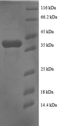 Recombinant Human Small ribosomal subunit protein eS25 (RPS25) – Figure 1 of 1