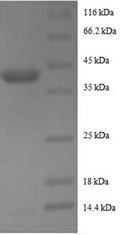 Recombinant Human Active regulator of SIRT1 protein (RPS19BP1) – Figure 1 of 1