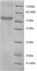 Recombinant Human 40S ribosomal protein S9 (RPS9), partial – Figure 1 of 1