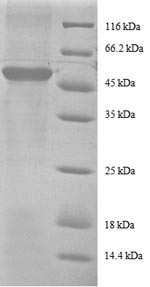 Recombinant Human 40S ribosomal protein S9 (RPS9), partial – Figure 1 of 1