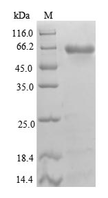 Recombinant Human Beta-1,4-galactosyltransferase 3 (B4GALT3), partial – Figure 1 of 1