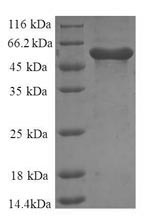 Recombinant Human Annexin A6 (ANXA6), partial – Figure 1 of 1
