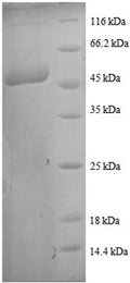 Recombinant Human Transgelin (TAGLN) – Figure 1 of 1
