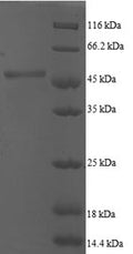 Recombinant Human ADP-ribosylation factor 5 (ARF5) – Figure 1 of 1