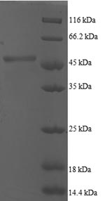 Recombinant Human ADP-ribosylation factor 5 (ARF5) – Figure 1 of 1