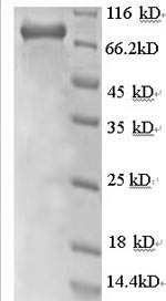 Recombinant Human Rab GDP dissociation inhibitor beta (GDI2), partial – Figure 1 of 1