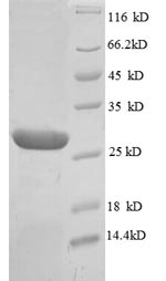 Recombinant Human Scaffold protein ILK (ILK), partial – Figure 1 of 1