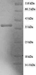 Recombinant Human Death-associated protein 1 (DAP) – Figure 1 of 1