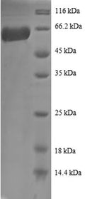 (Tris-Glycine gel) Discontinuous SDS-PAGE (reduced) with 5% enrichment gel and 15% separation gel.