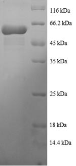 Recombinant Human Tetratricopeptide repeat protein 1 (TTC1), partial – Figure 1 of 1