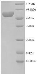 Recombinant Human Spermidine synthase (SRM), partial – Figure 1 of 1