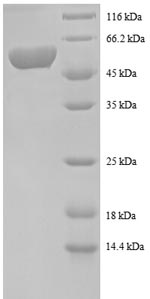 Recombinant Human Spermidine synthase (SRM), partial – Figure 1 of 1