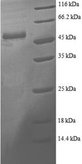 Recombinant Human Proteasome activator complex subunit 2 (PSME2) – Figure 1 of 1