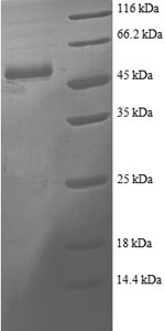 Recombinant Human Proteasome activator complex subunit 2 (PSME2) – Figure 1 of 1